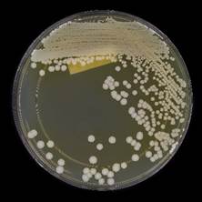 A strain of Candida auris cultured at the NYSDOH public health laboratory, Wadsworth Center.