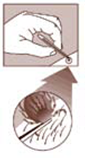 Ticks Removal Illustration #1